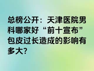 总榜公开：天津医院男科哪家好“前十宣布”包皮过长造成的影响有多大？
