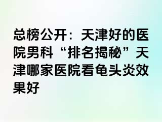总榜公开：天津好的医院男科“排名揭秘”天津哪家医院看龟头炎效果好